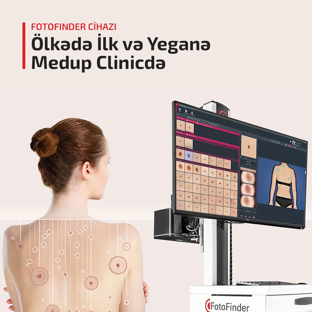 Dermatologiya - FotoFinder Cihazı - Medup Clinic